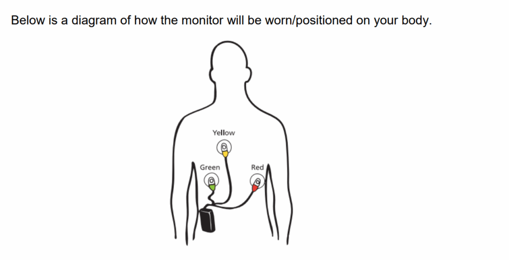 Below is a diagram of how the monitor will be worn/positioned on your body.

Green left, yellow middle, red right