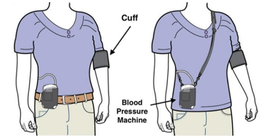 Image of where the cuff and blood pressure monitor go.