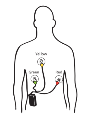 This is a diagram of how the monitor will be worn and positioned on your body.