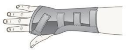Photo example of a splint.