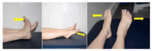 Ankle Rotation Rom Ankle Sprain Patient Information Leaflet - The Princess Alexandra ...
